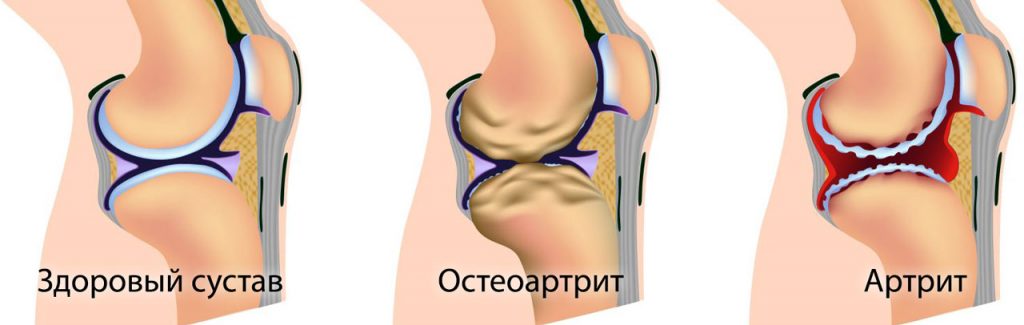 Healthy knees – easy!